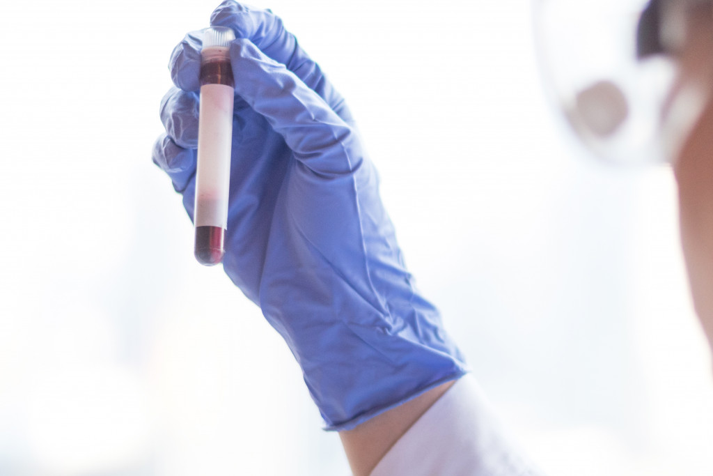 scientist holding a test tube with blood sample